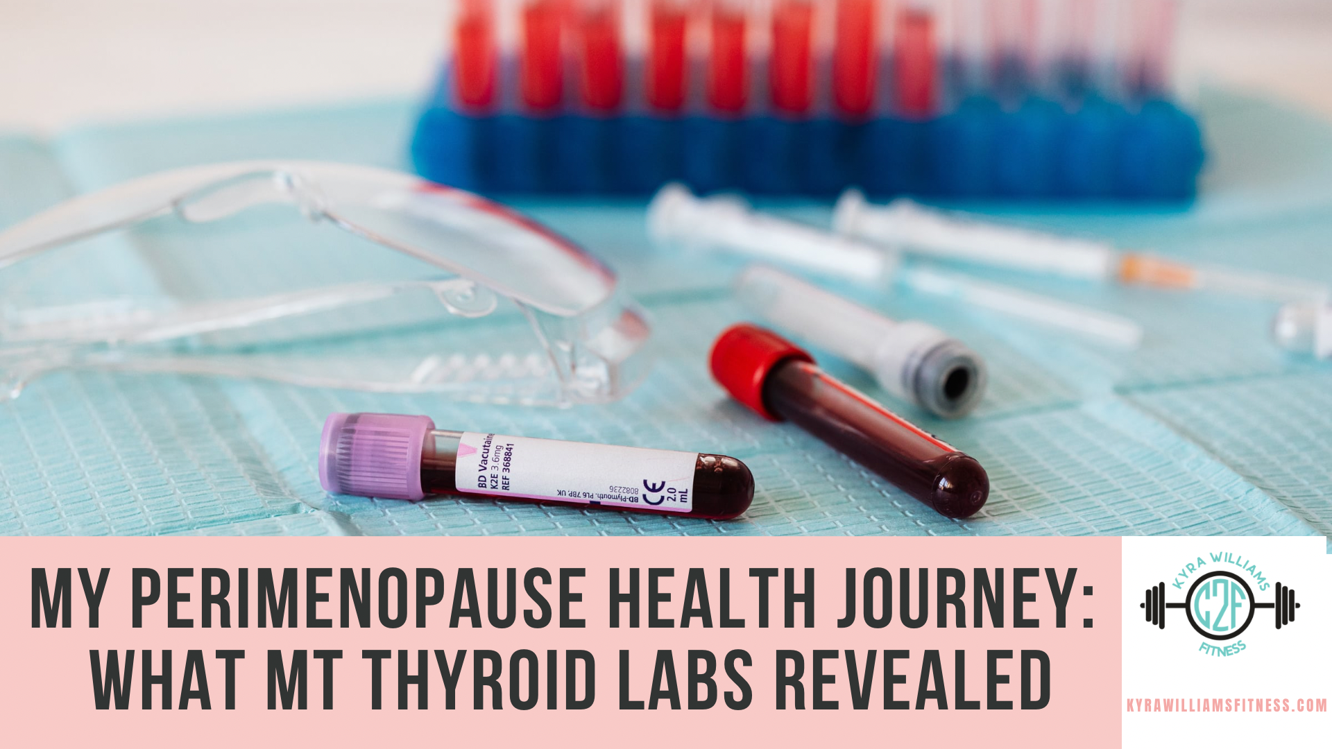 My Perimenopause Health Journey Part II: What My Thyroid Labs Revealed
